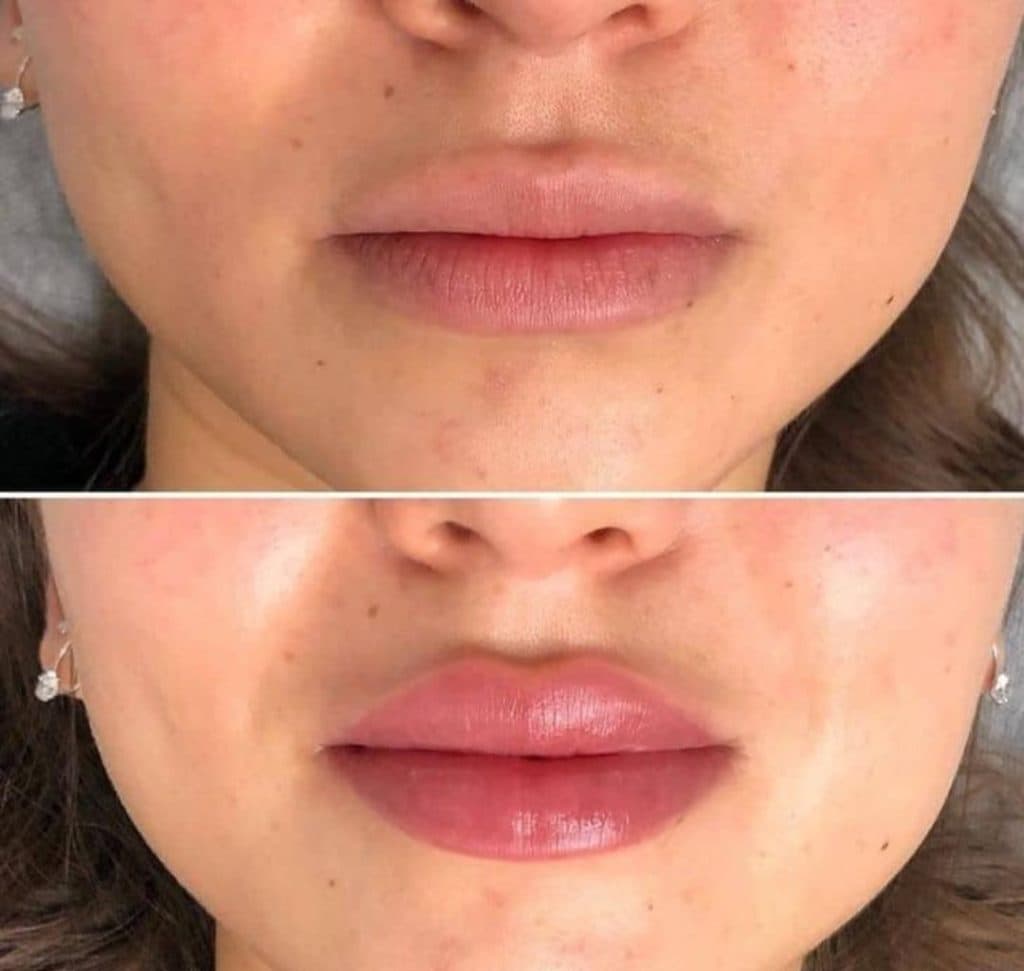 کلینیک زیبایی لیزر راسپینا در امیرکبیر کرمان