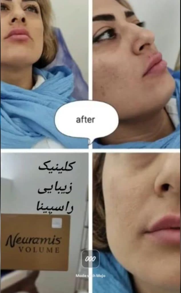 کلینیک زیبایی لیزر راسپینا در امیرکبیر کرمان