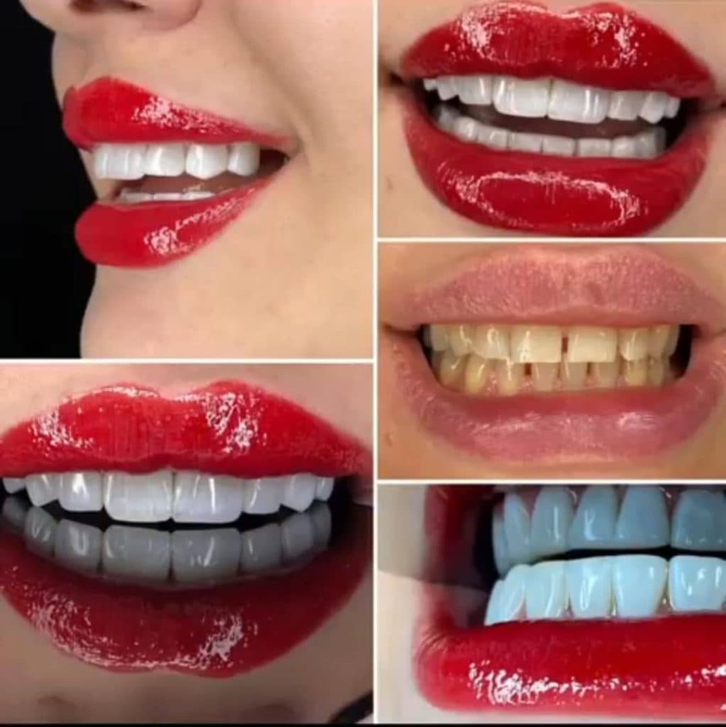 کلینیک تخصصی کامپوزیت و ایمپلنت دندان کیارش در رشت