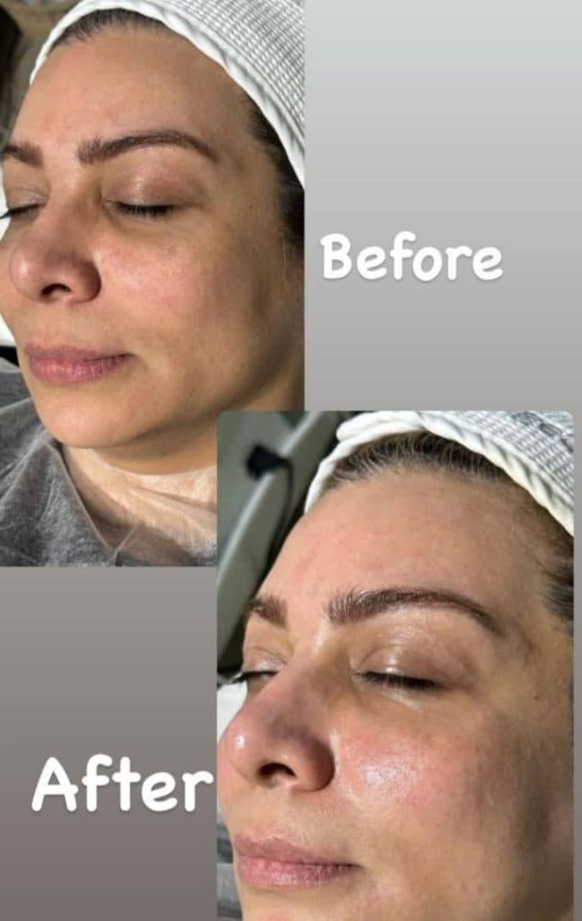 آموزش فشیال و پاکسازی پوست مریم فیروزی در قائمشهر