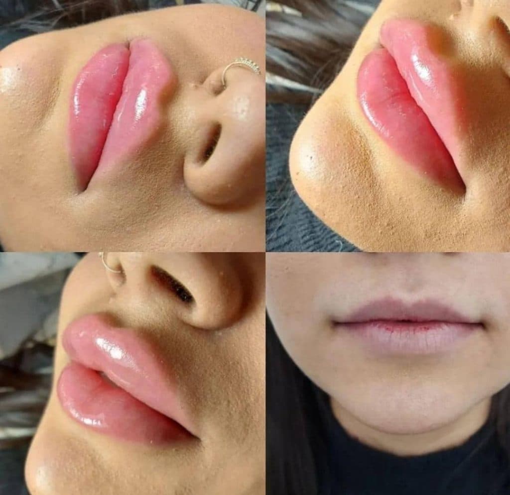 کلینیک زیبایی پوست و مو مارال در کرج