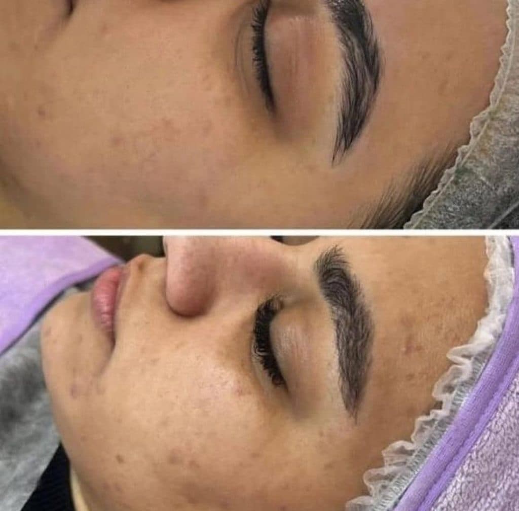 خدمات تخصصی فشیال و پاکسازی پوست صدیقه خیرمند در رفسنجان
