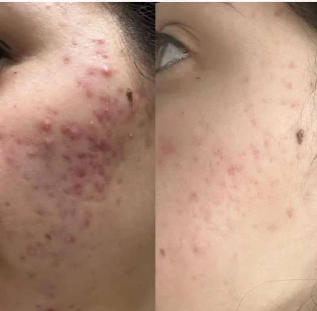 خدمات تخصصی فشیال و پاکسازی پوست صدیقه خیرمند در رفسنجان