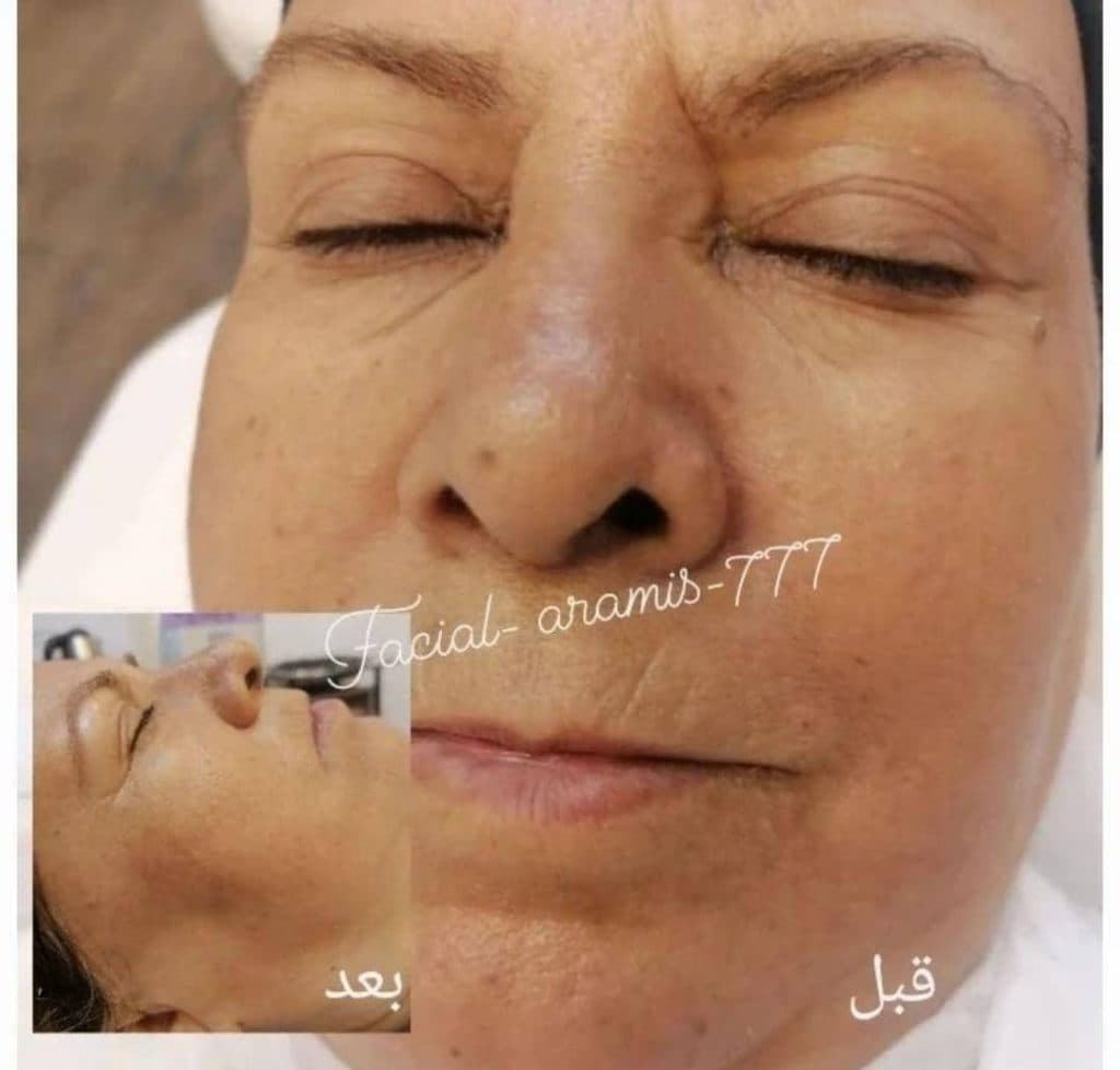خدمات تخصصی فشیال و پاکسازی پوست صدیقه خیرمند در رفسنجان