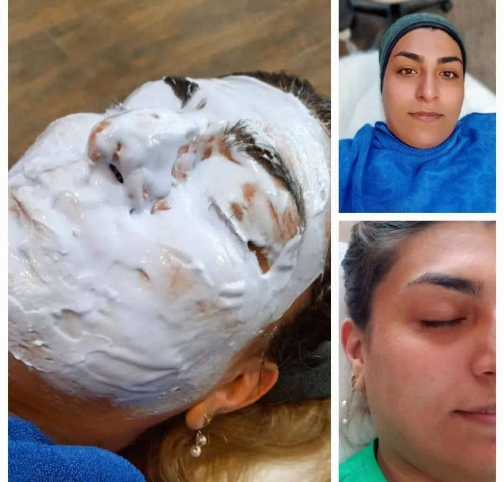 خدمات تخصصی فشیال و پاکسازی پوست صدیقه خیرمند در رفسنجان
