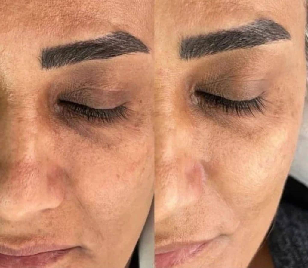 خدمات تخصصی فشیال و پاکسازی پوست صدیقه خیرمند در رفسنجان