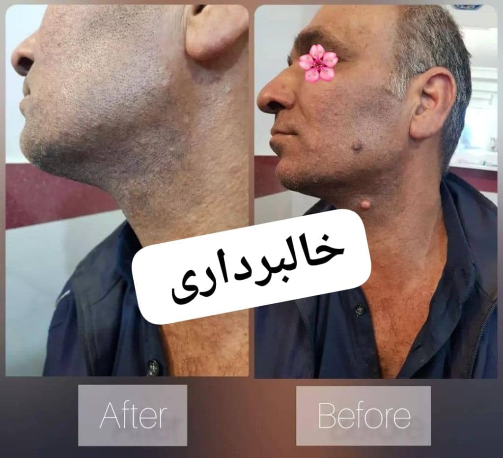 مطب زیبایی پوست و مو دکتر محمود صادقلو در آزادشهر