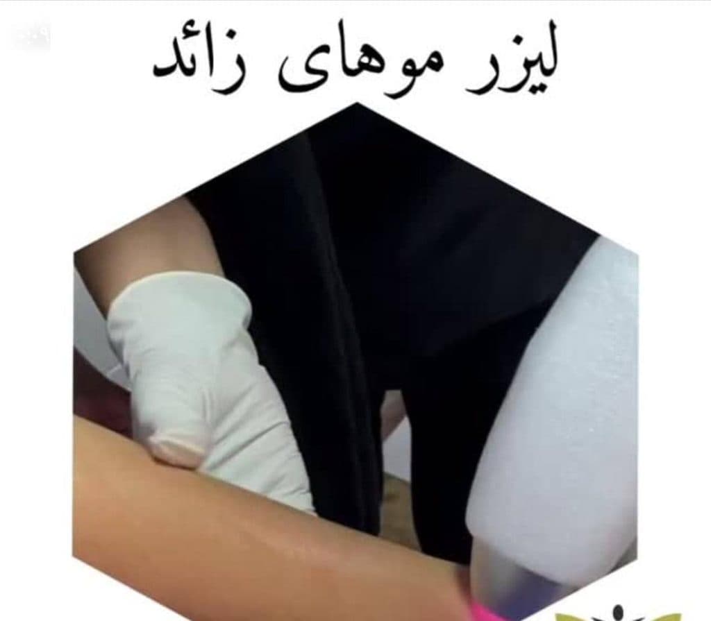 مرکز تخصصی لیزر موهای زائد پارادایس در تبریز