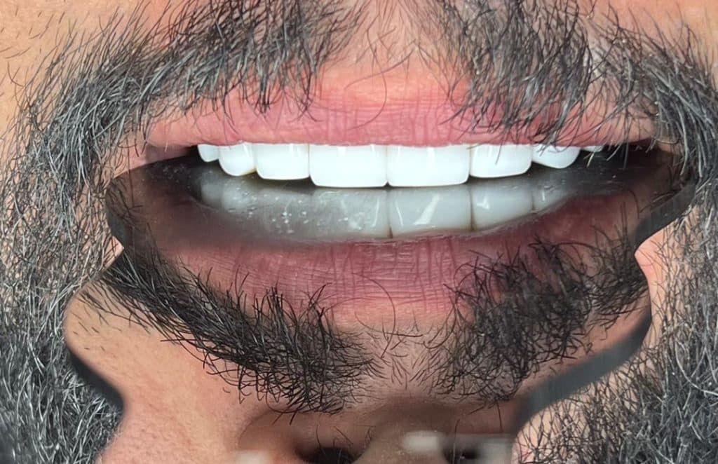 کلینیک تخصصی کامپوزیت و ایمپلنت دندان کیارش در رشت