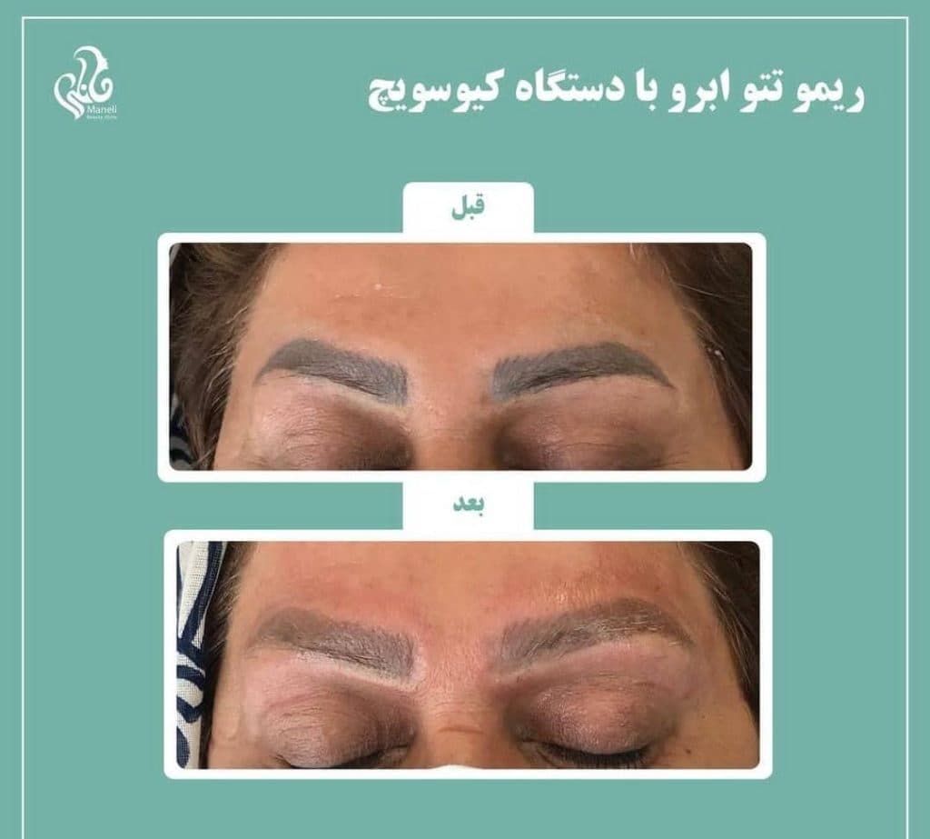 کلینیک زیبایی پوست و مو مانلی در کرج
