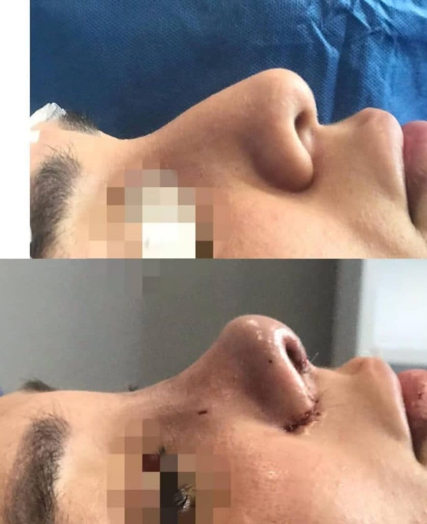 کلینیک عمل جراحی بینی اشکا در اهواز