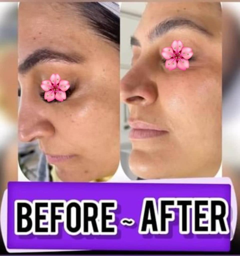 آموزشگاه فنی حرفه ای پاکسازی پوست زهرا نجفی در نظرآباد