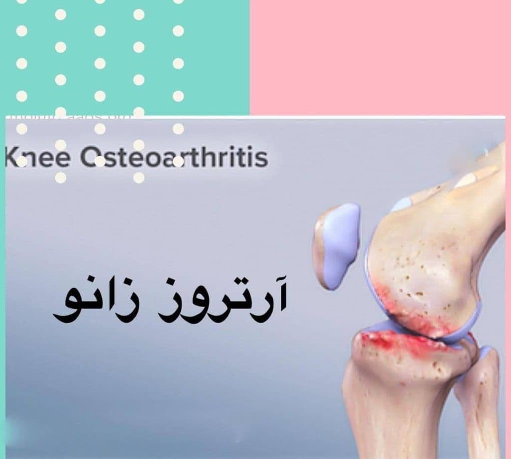 کلینیک طب فیزیکی و توانبخشی دکتر نیکبخت در همدان