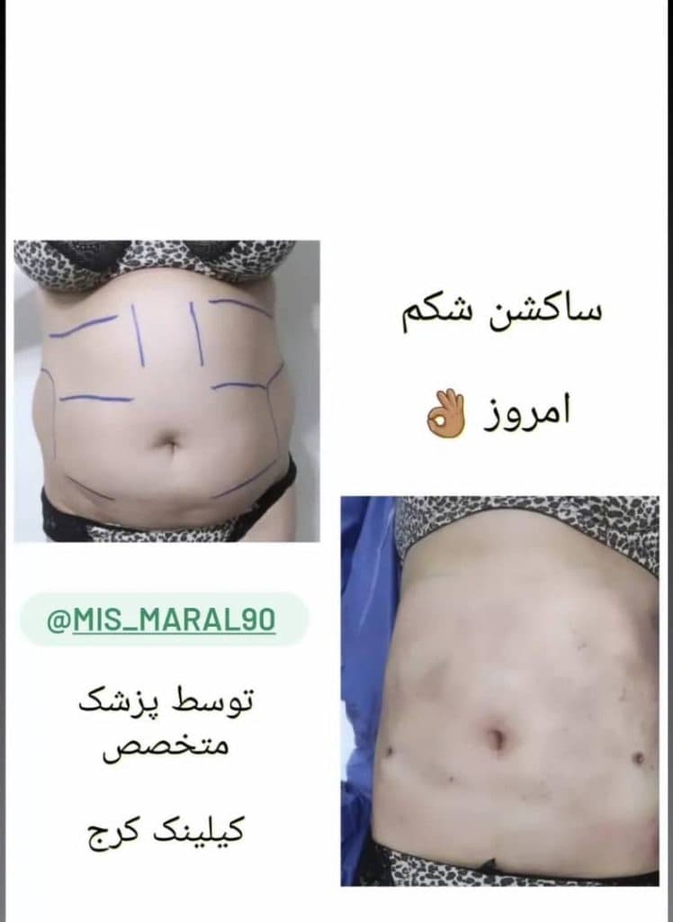 کلینیک زیبایی پوست و مو مارال در کرج