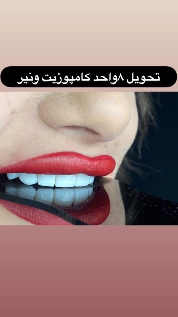 کلینیک تخصصی کامپوزیت و ایمپلنت دندان کیارش در رشت