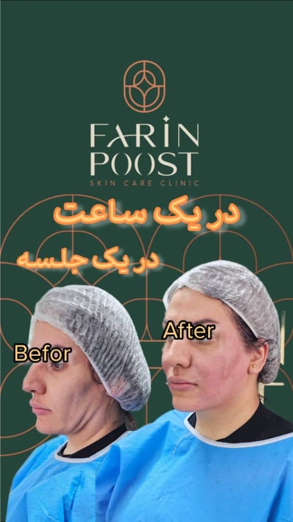 مرکز زیبایی پوست و مو فرین پوست در مصلی اصفهان