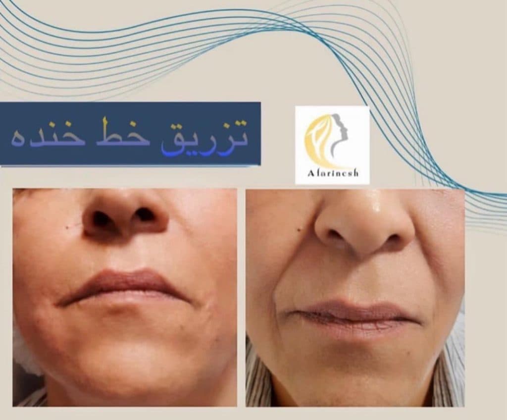 کلینیک زیبایی دکتر مهدی قهرمانیان در سعادت آباد تهران