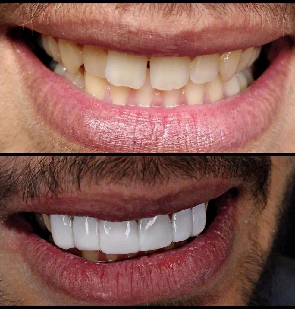 کلینیک تخصصی کامپوزیت و ایمپلنت دندان کیارش در رشت