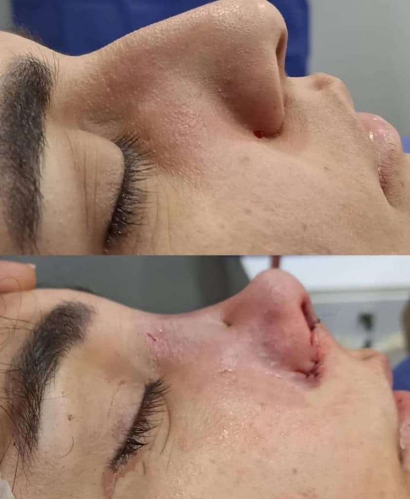 کلینیک عمل جراحی بینی اشکا در اهواز