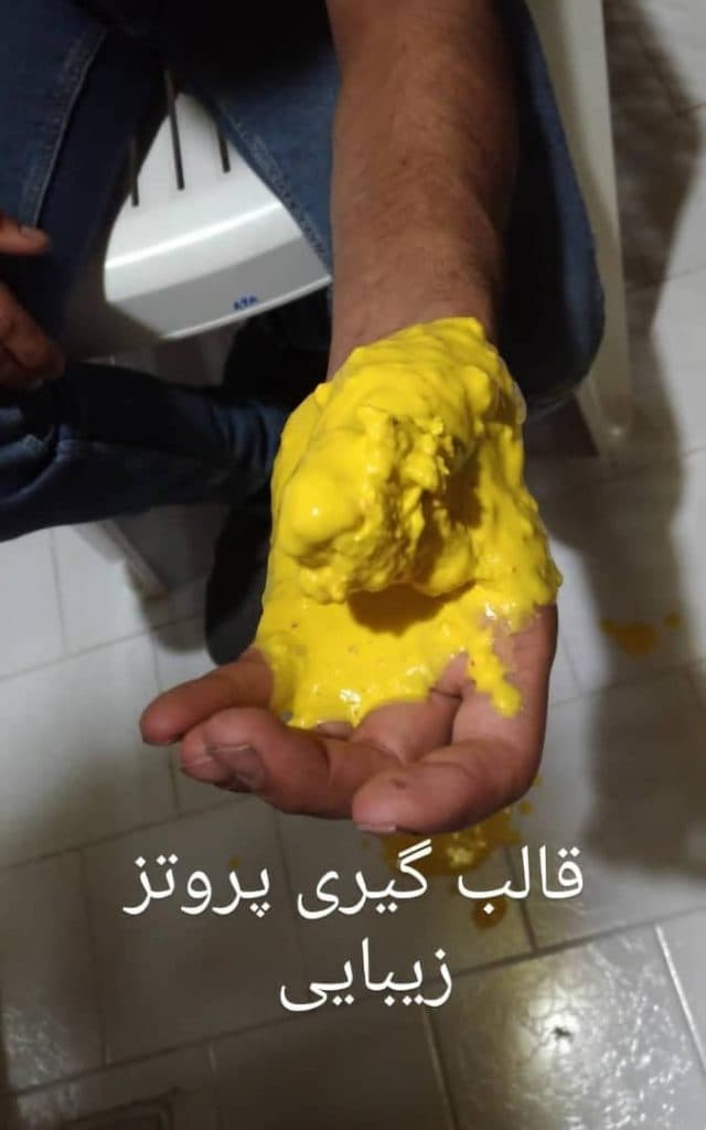 طراحی و ساخت دست و انگشت مصنوعی ارتوپد فنی یزدان در یزد