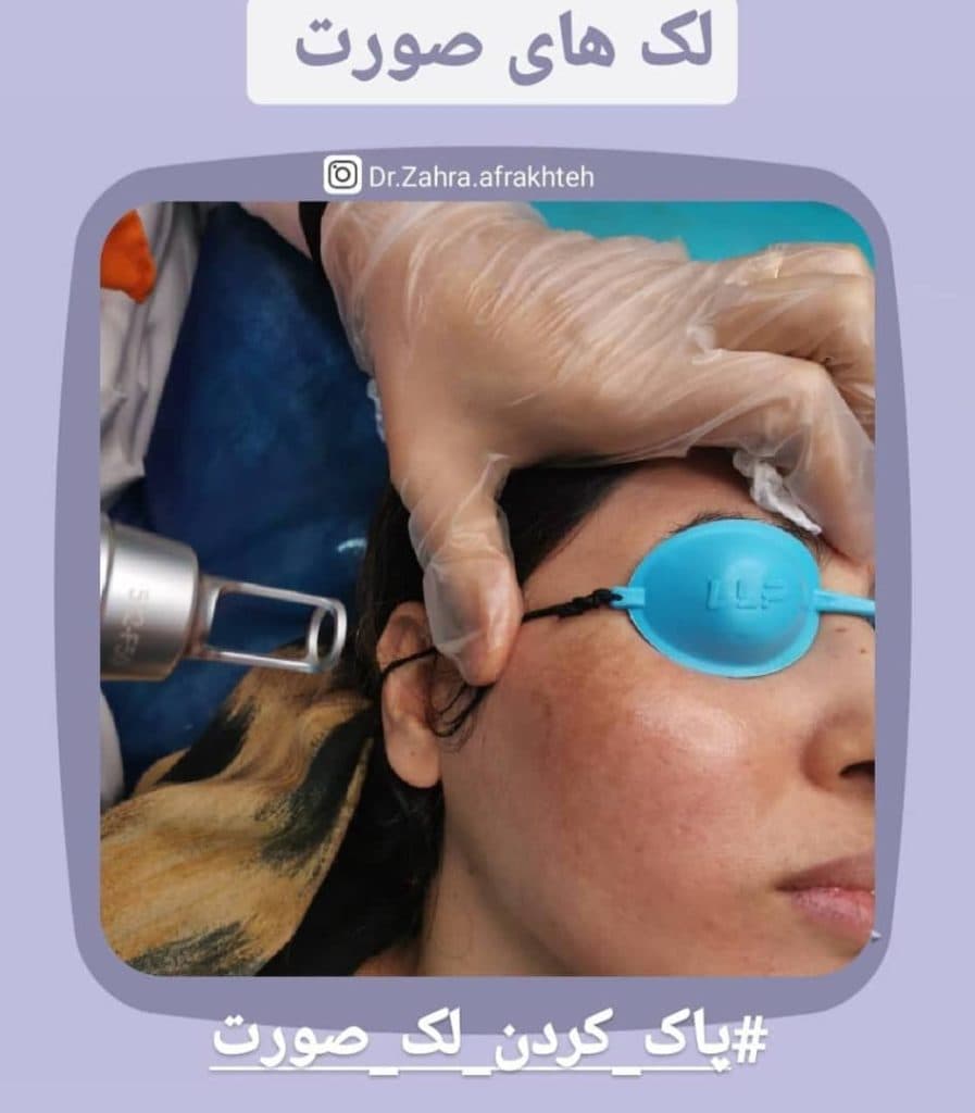 کلینیک زیبایی دکتر زهرا افراخته در کیانپارس تهران