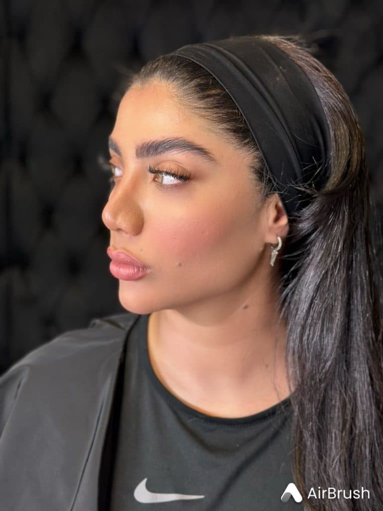 خدمات تخصصی تزریق فیلر لب روسی شاهرودی طب در سعادت آباد تهران