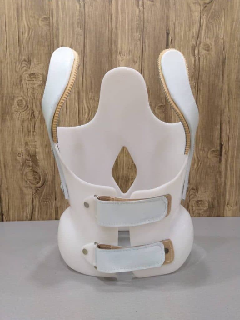 ساخت و طراحی کمربندهای اصلاحی اسکولیوز ارتوپد فنی یزدان در یزد