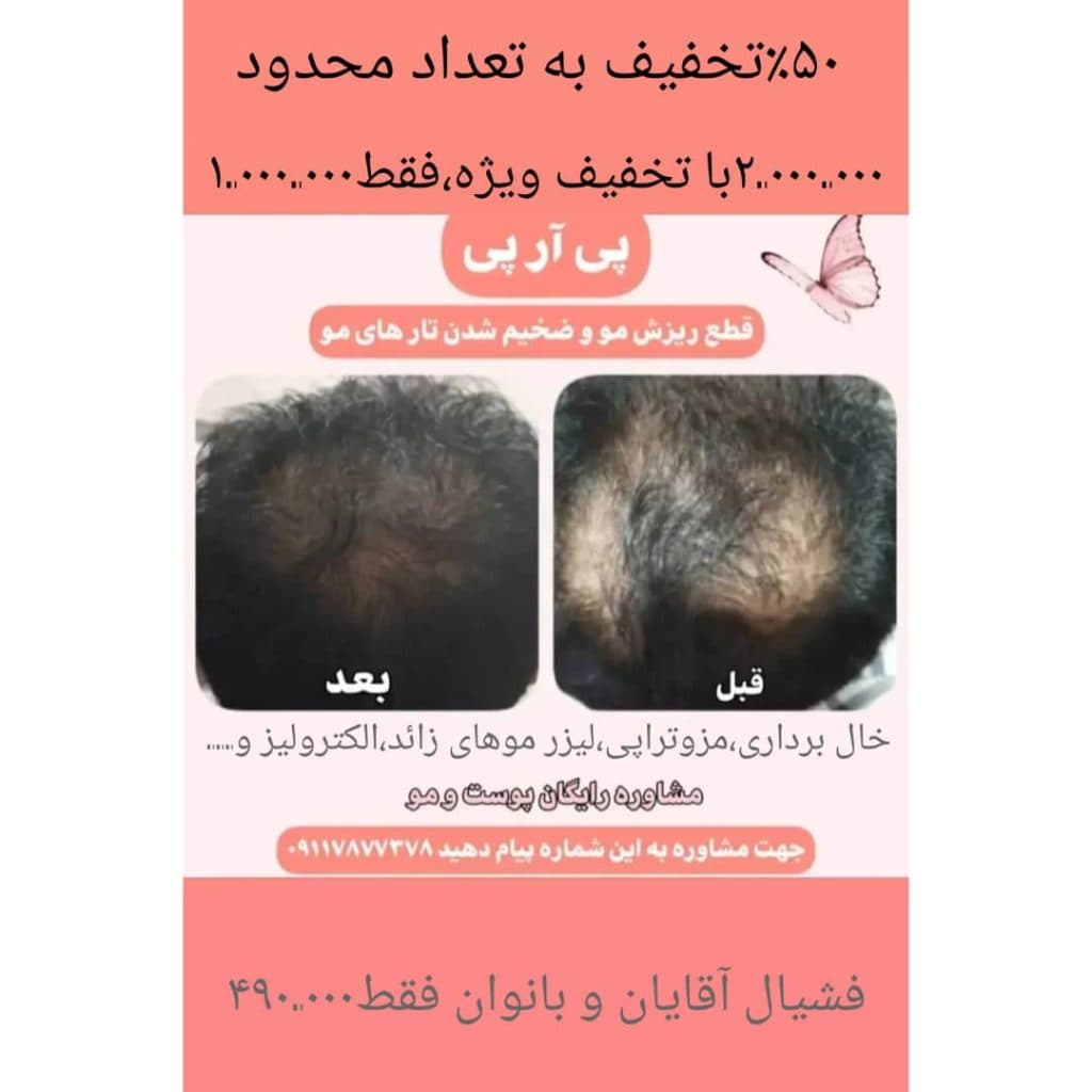 مطب زیبایی حورا در تهران