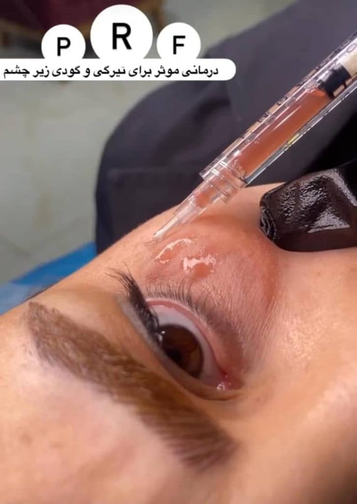 کلینیک زیبایی دکتر زهرا افراخته در کیانپارس تهران