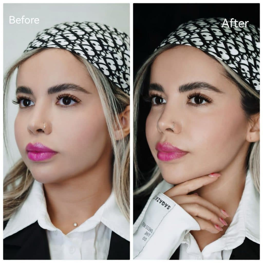 خدمات تخصصی تزریق مزوژل جوانساز شاهرودی طب در سعادت آباد تهران