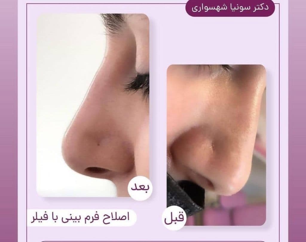 کلینیک زیبایی دکتر سونیا شهسواری در سنندج
