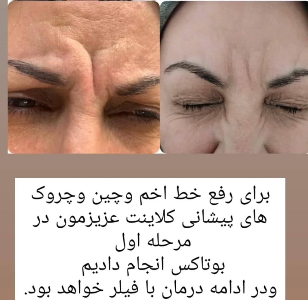 کلینیک زیبایی برتر یوسفی در تبریز