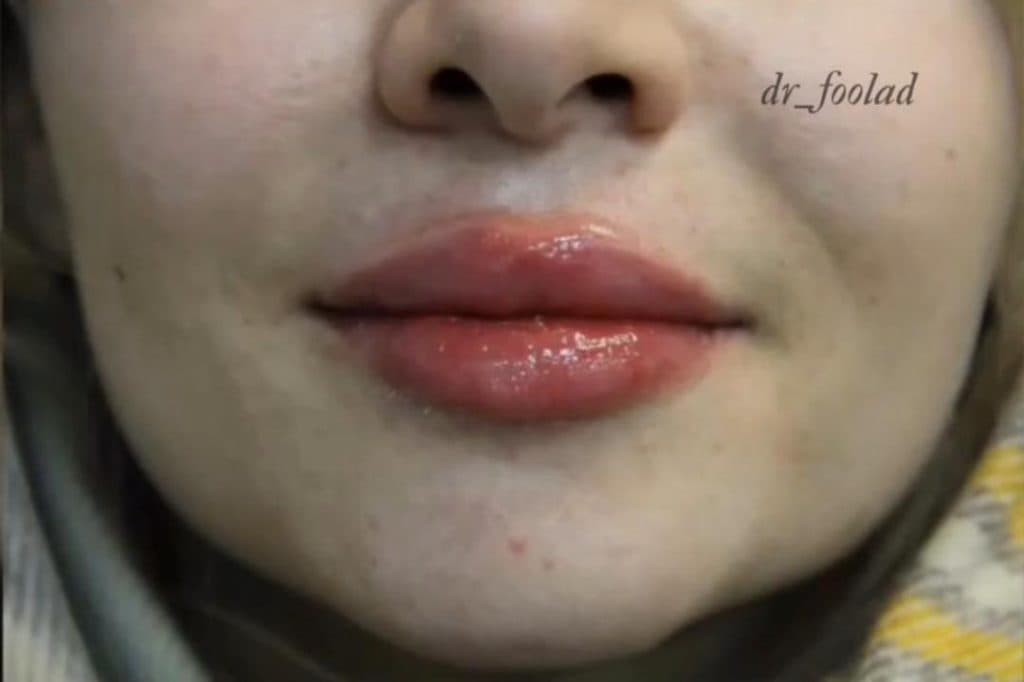 مطب زیبایی دکتر فولاد در فردوس غرب تهران