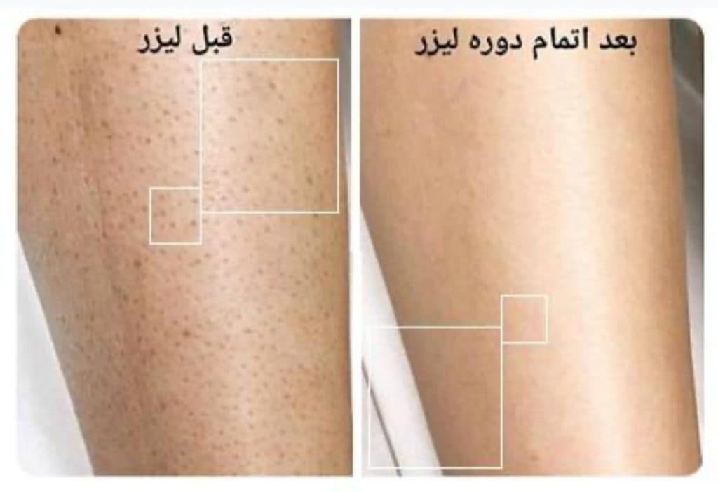 کلینیک زیبایی لیزر آمیتیس در شهرک بهشتی دیلمان رشت