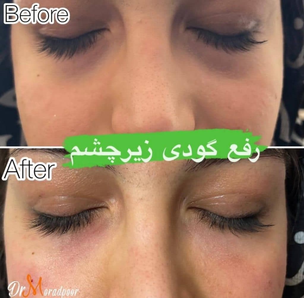 مرکز زیبایی لبخند در سمنان