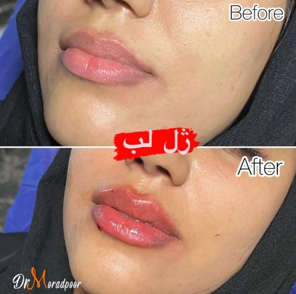 مرکز زیبایی لبخند در سمنان