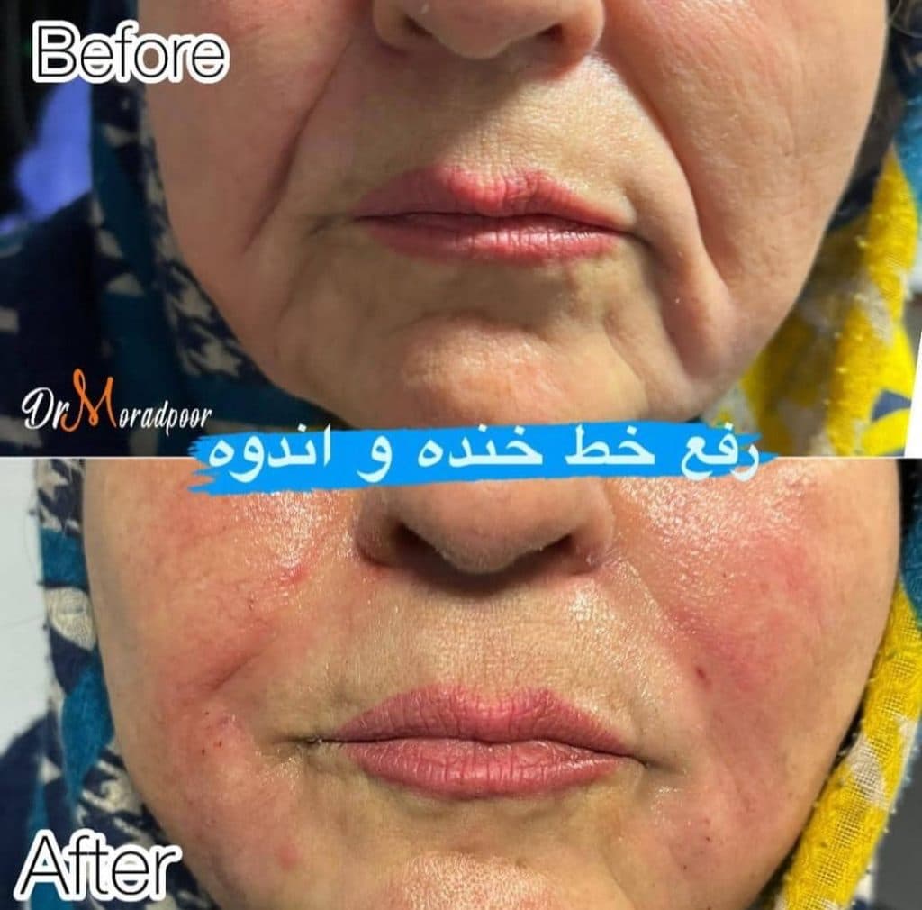 مرکز زیبایی لبخند در سمنان