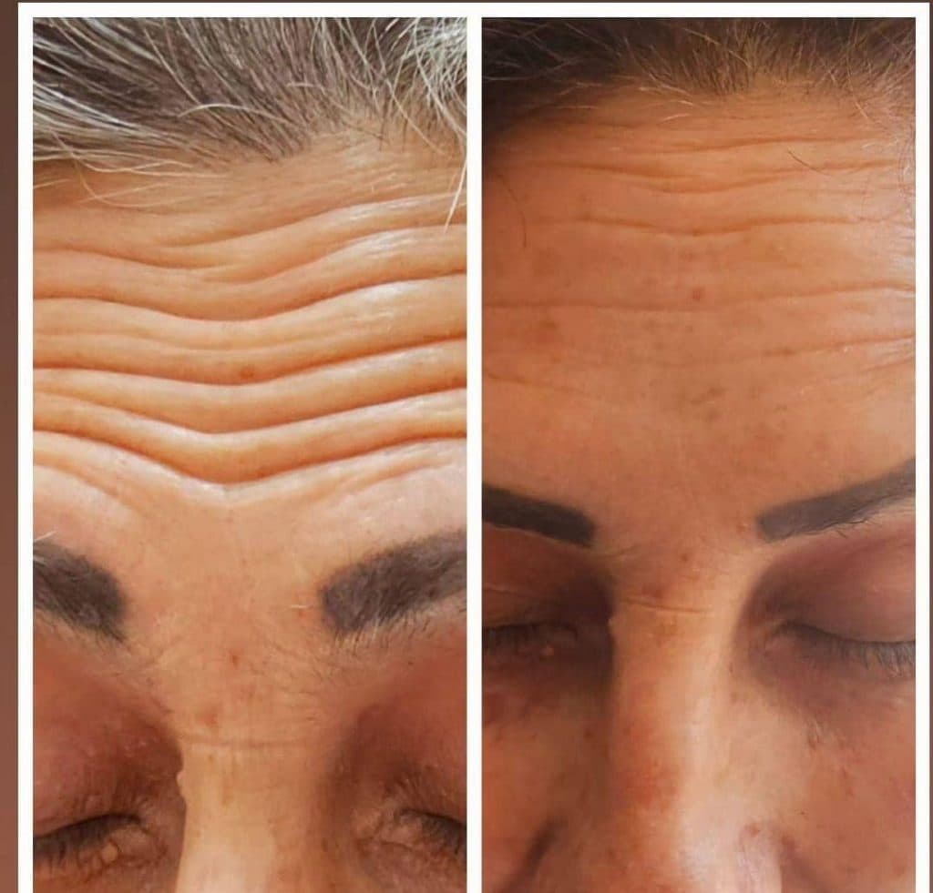 خدمات پوست مو و زیبایی دکتر فاطمه یعقوبی در بروجن