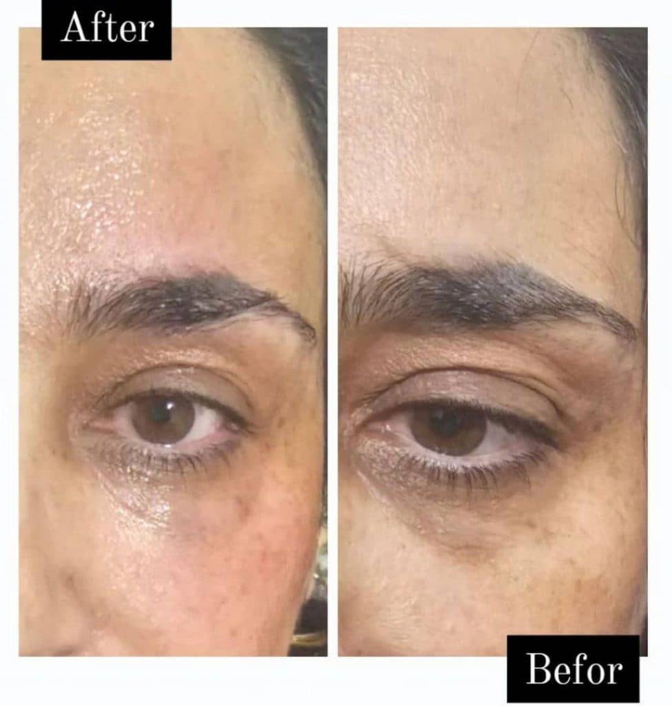 خدمات پوست مو و زیبایی دکتر فاطمه یعقوبی در بروجن