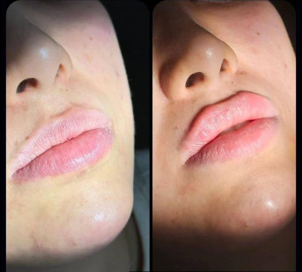 خدمات پوست مو و زیبایی دکتر فاطمه یعقوبی در بروجن