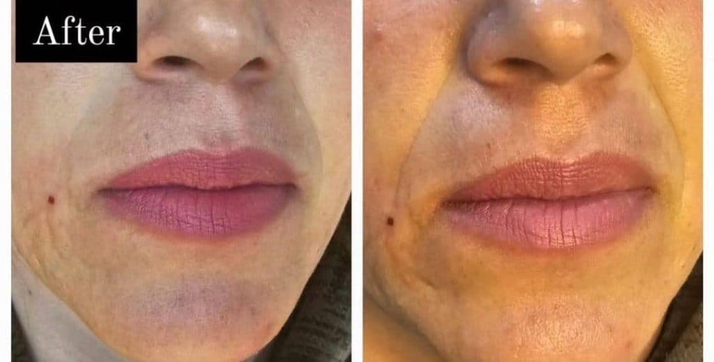 خدمات پوست مو و زیبایی دکتر فاطمه یعقوبی در بروجن