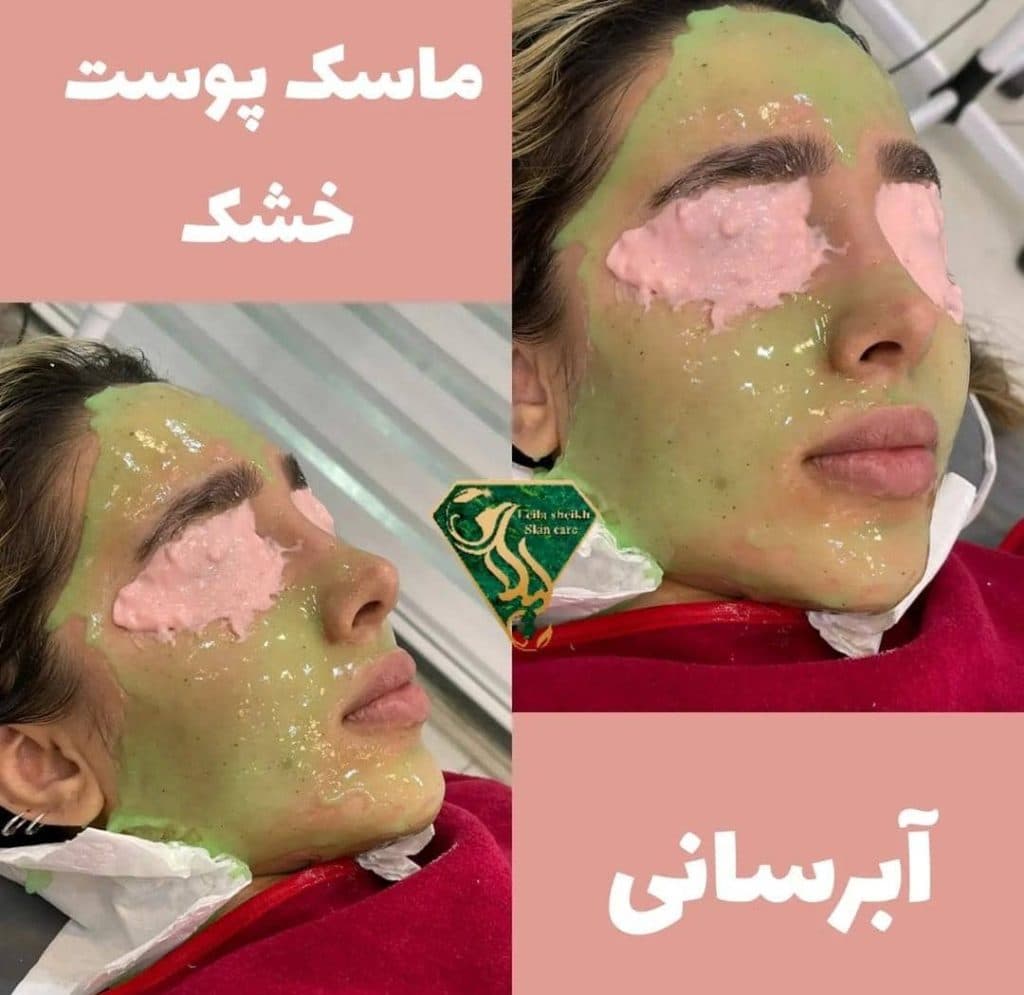 کلینیک جوانسازی پوست الماس غرب در خرم آباد