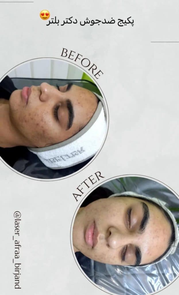 کلینیک زیبایی لیزر افرا در بیرجند