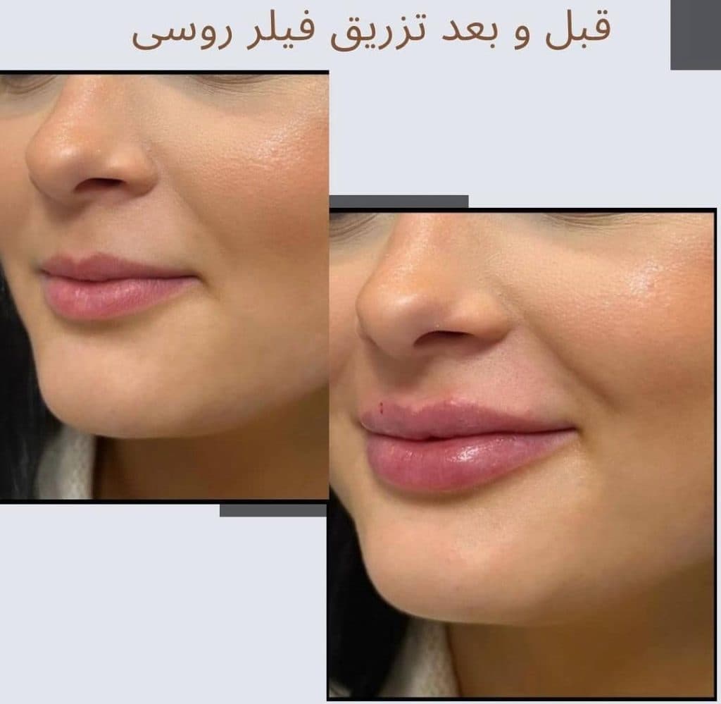 مرکز تخصصی زیبایی درمالوکس در مهرویلا