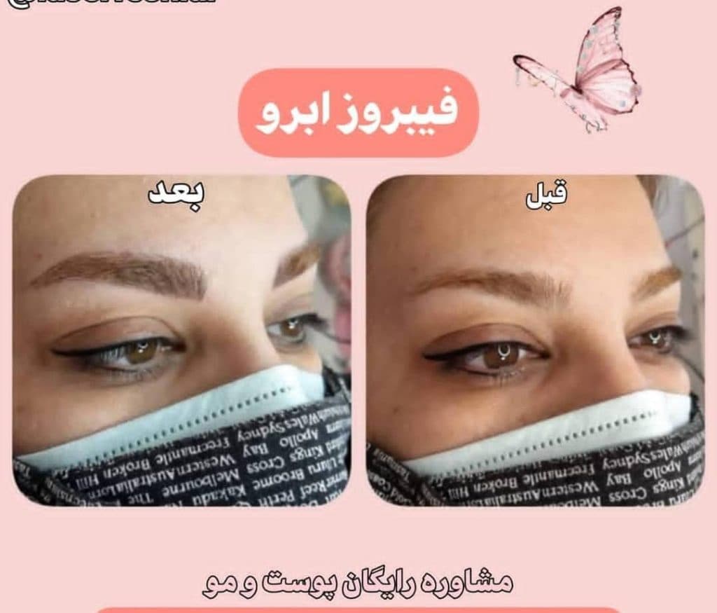 مطب زیبایی حورا در تهران