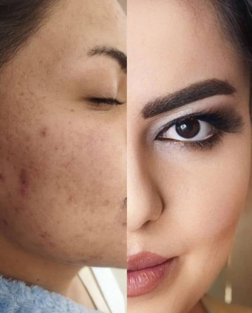 آموزشگاه و سالن زیبایی کی ناز در چایپاره