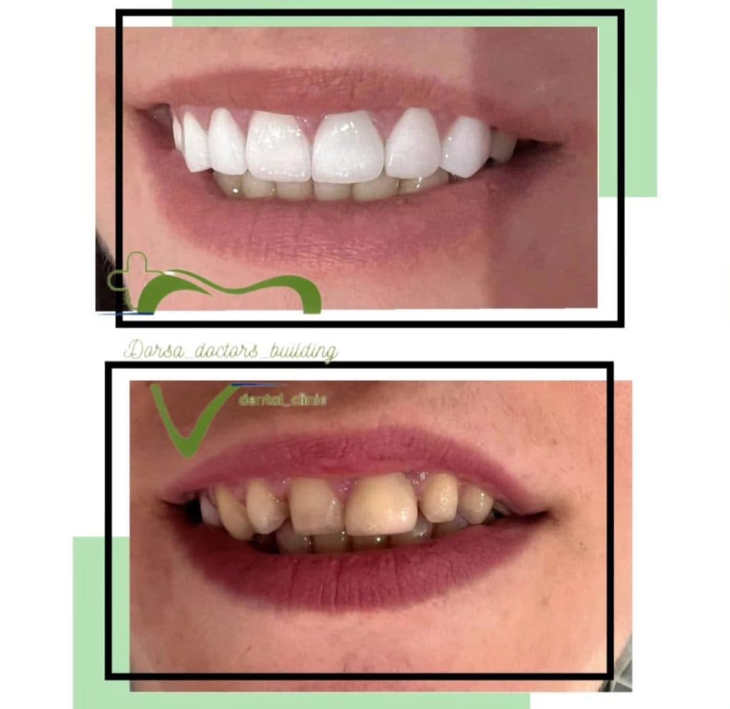 کلینیک دندانپزشکی درسا در مطهری خرم آباد