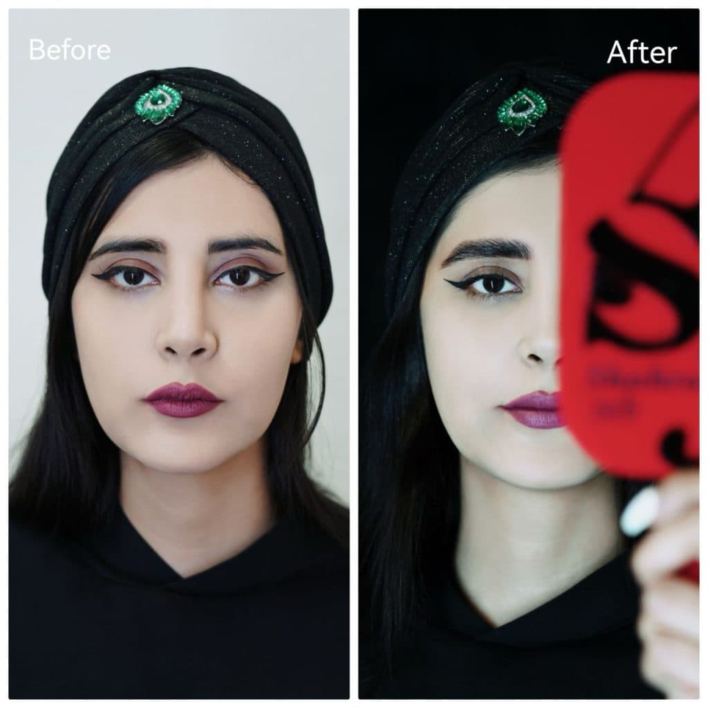 خدمات تخصصی تزریق مزوژل جوانساز شاهرودی طب در سعادت آباد تهران