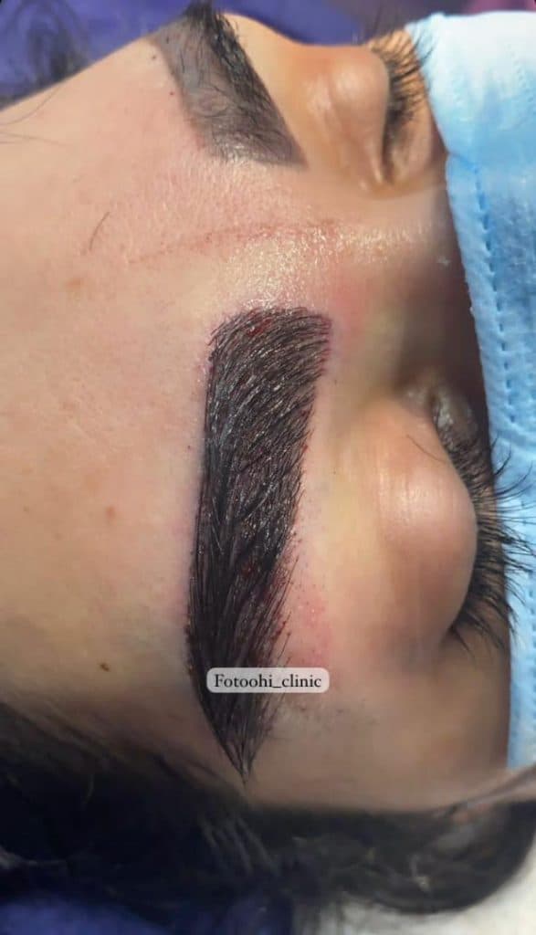 مرکز زیبایی لیزر فتوحی در تهران