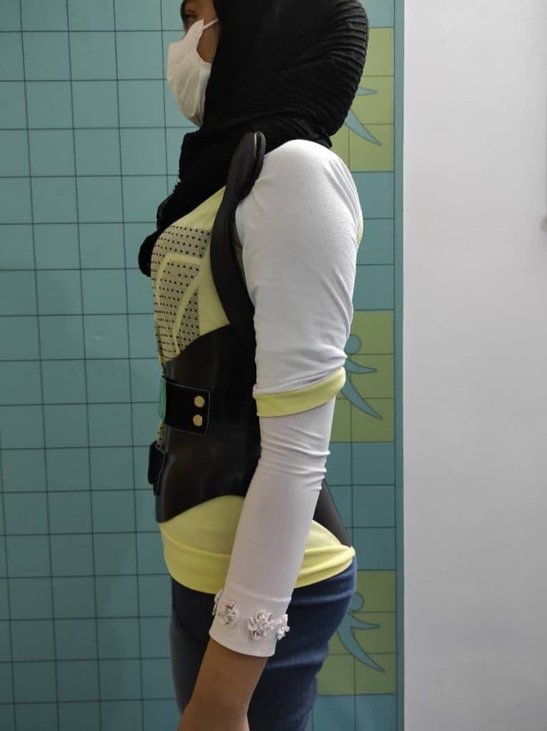 ساخت و طراحی کمربندهای اصلاحی اسکولیوز ارتوپد فنی یزدان در یزد